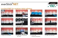 EverStick NET - Travma Geçirmiş Dişlerin Kolay ve Estetik Splintlenmesi için