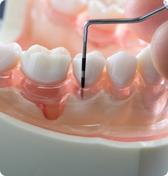 Periodontoloji